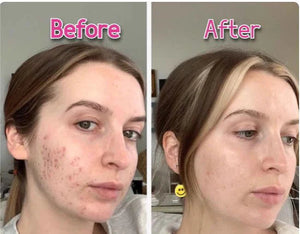 3-in-1 Facial & Neck Beauty Device – EMS Lifting, LED Therapy & Double Chin Treatment